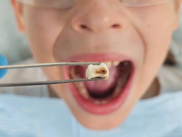 Best Walk-In Emergency Dentist in Crandon, WI